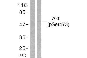 Western Blotting (WB) image for anti-V-Akt Murine Thymoma Viral Oncogene Homolog 1 (AKT1) (pSer473) antibody (ABIN1847446) (AKT1 antibody  (pSer473))