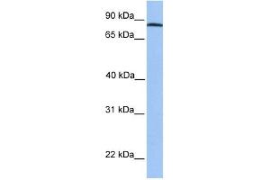 ADAM7 antibody used at 1 ug/ml to detect target protein. (ADAM7 antibody  (C-Term))