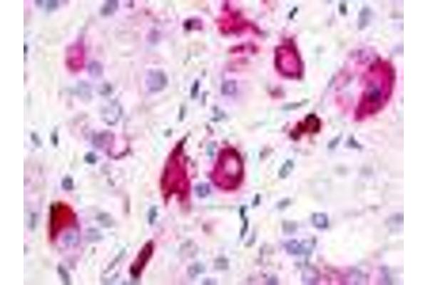 G Protein-Coupled Receptor 12 antibody  (Extracellular Domain)