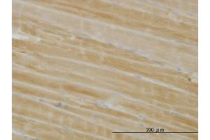 Immunoperoxidase of monoclonal antibody to PHKG1 on formalin-fixed paraffin-embedded human skeletal muscle. (PHKG1 antibody  (AA 1-387))