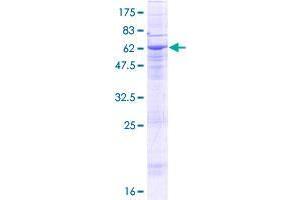 Image no. 1 for Sterile alpha Motif Domain Containing 8 (SAMD8) (AA 1-326) protein (GST tag) (ABIN1319136) (SAMD8 Protein (AA 1-326) (GST tag))