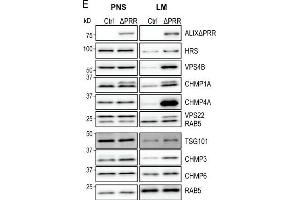 Western Blotting (WB) image for anti-Hepatocyte Growth Factor-Regulated tyrosine Kinase Substrate (HGS) (C-Term) antibody (ABIN2855140)