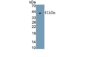 Detection of Recombinant TRF, Human using Polyclonal Antibody to Transferrin (TF) (Transferrin antibody  (AA 361-683))