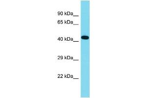 Host: Rabbit Target Name: C16orf91 Sample Type: Fetal Lung lysates Antibody Dilution: 1. (CCSMST1 antibody  (C-Term))
