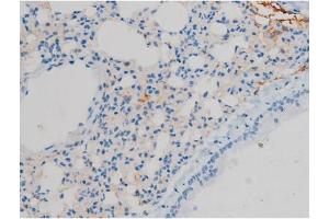 ABIN6267410 at 1/200 staining Mouse lung tissue sections by IHC-P. (Connexin 43/GJA1 antibody  (pSer368))