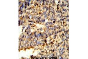 Immunohistochemistry (IHC) image for anti-Fc Fragment of IgG, Low Affinity IIc, Receptor For (CD32) (FCGR2C) antibody (ABIN3003995) (FCGR2C antibody)