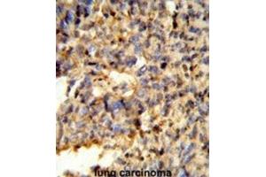 Immunohistochemistry (IHC) image for anti-Fc Fragment of IgG, Low Affinity IIc, Receptor For (CD32) (FCGR2C) antibody (ABIN3003995)