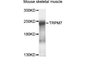 Western blot analysis of extracts of mouse skeletal muscle cells, using TRPM7 antibody.
