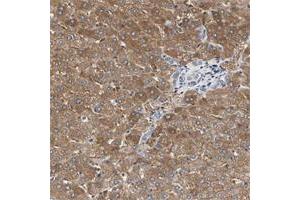 Immunohistochemical staining of human lymph node with C3orf52 polyclonal antibody  shows strong cytoplasmic positivity in reaction center cells at 1:200-1:500 dilution. (C3orf52 antibody)