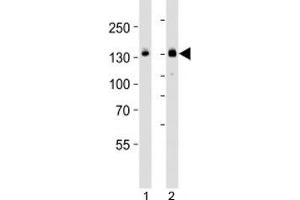 Western blot analysis of lysate from HT-29 cell line and mouse spleen tissue lysate (left to right) using JAK1 antibody; Ab was diluted at 1:1000 for each lane.