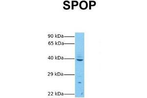 Host:  Rabbit  Target Name:  SPOP  Sample Tissue:  Human MCF7  Antibody Dilution:  1. (SPOP-B antibody  (C-Term))