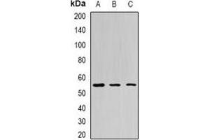 Western blot analysis of BPI expression in Jurkat (A), HepG2 (B), mouse liver (C) whole cell lysates. (BPI antibody)