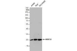 WB Image NDUFS3 antibody detects NDUFS3 protein by western blot analysis. (NDUFS3 antibody  (Center))
