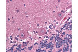 Anti-CCT2 antibody IHC of human brain, cerebellum. (CCT2 antibody)