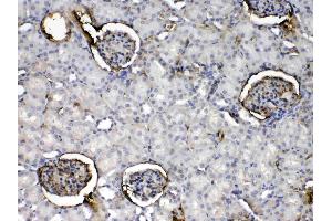 IHC analysis of Crp using anti- Crp antibody . (CRP antibody  (AA 20-225))