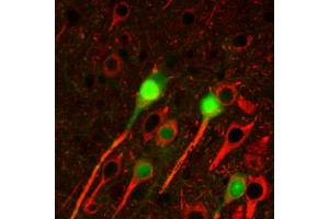 Immunohistochemistry staining of betaIII tubulin (red) in tissue sections of murine brain expressing GFP in some of its neurons (green). (TUBB3 antibody  (N-Term))