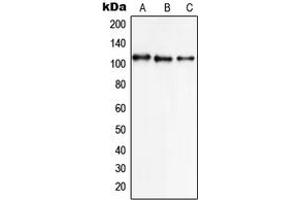 Western blot analysis of NCX1 expression in K562 (A), A549 (B), HL60 (C) whole cell lysates. (SLC8A1 antibody  (Center))