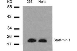 Image no. 3 for anti-Stathmin 1 (STMN1) (Ser24) antibody (ABIN197454) (Stathmin 1 antibody  (Ser24))