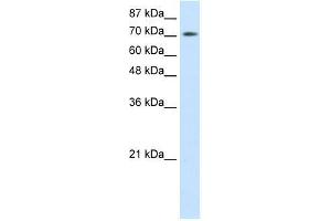 r-ZBTB48; WB Suggested Anti-ZBTB48 Antibody Titration: 0. (ZBTB48 antibody  (N-Term))