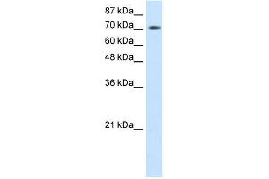 r-ZBTB48; WB Suggested Anti-ZBTB48 Antibody Titration: 0.
