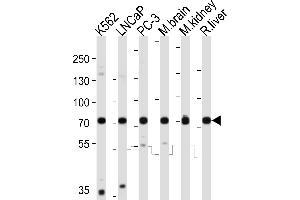 Western blot analysis of lysates from K562, LNCaP, PC-3 cell line, mouse brain, mouse kidney, rat liver tissue lysate (from left to right), using C Antibody (C-term) (ABIN6243097 and ABIN6577815). (CD164 antibody  (C-Term))