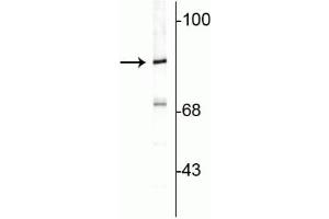 Western blot of rat cortical lysate showing specific immunolabeling of the ~82 kDa rabphilin 3A. (RPH3A antibody  (C-Term))