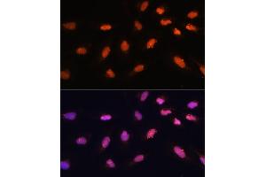 Immunofluorescence analysis of U-2 OS cells using BA antibody (ABIN7265937) at dilution of 1:100. (BAZ2A antibody)