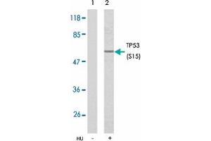 Western blot analysis of extracts from HeLa cells treated with hydroxyurea using TP53 (phospho S15) polyclonal antibody . (p53 antibody  (pSer15))
