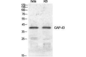 Western Blotting (WB) image for anti-Growth Associated Protein 43 (GAP43) (Ser421) antibody (ABIN3175217) (GAP43 antibody  (Ser421))