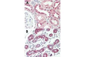 Immunohistochemical staining (Formalin-fixed paraffin-embedded sections) of human kidney (A) and human breast (B) with AVPR1A monoclonal antibody, clone 721CT25. (AVPR1A antibody  (AA 353-383))