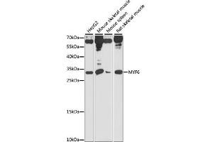 Western blot analysis of extracts of various cell lines, using MYF6 antibody (ABIN7268738) at 1:1000 dilution. (MYF6 antibody  (AA 80-180))