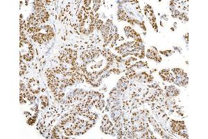Immunohistochemistry (IHC) image for anti-SET Nuclear Oncogene (SET) (AA 125-175) antibody (ABIN7454812)