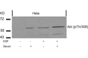 Western blot analysis of extracts from Hela cells untreated or treated with EGF, serum or both using Akt(Phospho-Thr308) Antibody. (AKT1 antibody  (pThr308))