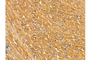ABIN6259192 and ABIN6274507 at 1/100 staining Rat heart tissue by IHC-P. (SLK antibody  (C-Term))