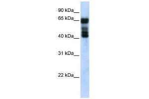 UGT2B4 antibody used at 1 ug/ml to detect target protein.