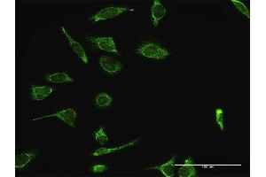 Immunofluorescence of purified MaxPab antibody to HSPA9 on HeLa cell.