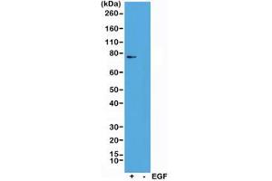 Western blot of A431 cells treated (+) or untreated (-) with EGF, using recombinant phospho-RSK1 antibody at 1:1000. (Recombinant RPS6KA1 antibody  (pSer363, pThr359))