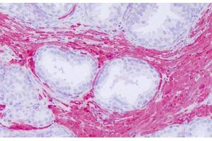 Image no. 2 for anti-Actin, gamma 2, Smooth Muscle, Enteric (ACTG2) (C-Term) antibody (ABIN6749799) (ACTG2 antibody  (C-Term))