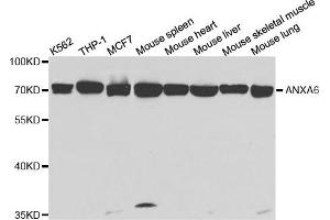 Western Blotting (WB) image for anti-Annexin A6 (ANXA6) antibody (ABIN1876578) (ANXA6 antibody)