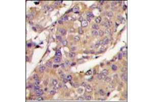 Image no. 2 for anti-Ubiquitin-Conjugating Enzyme E2L 6 (UBE2L6) (C-Term) antibody (ABIN357496) (UBE2L6 antibody  (C-Term))