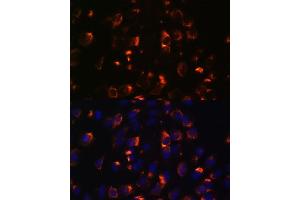Immunofluorescence analysis of C6 cells using CCDC47 antibody (ABIN7266438) at dilution of 1:100. (CCDC47 antibody  (AA 224-483))
