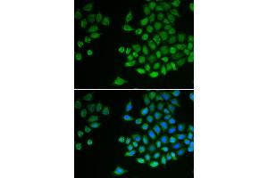 Immunofluorescence analysis of MCF-7 cells using PTPN2 antibody (ABIN5970915). (PTPN2 antibody)