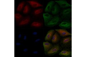 ABIN6257757 and ABIN6275874 staining  cells by IF/ICC.