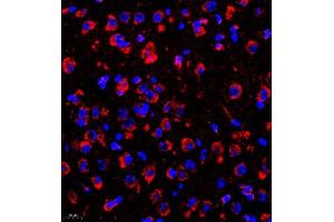 Immunofluorescence of paraffin embedded mouse brain using rasgrf1 (ABIN7073422) at dilution of 1:2000 (400x lens) (Cdc25 antibody)