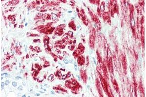 Human Prostate (formalin-fixed, paraffin-embedded) stained with DES antibody ABIN396919 at 10 ug/ml followed by biotinylated anti-mouse IgG secondary antibody ABIN481714, alkaline phosphatase-streptavidin and chromogen. (Desmin antibody)
