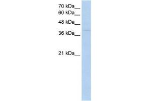 WB Suggested Anti-RNF165 Antibody Titration:  0. (RNF165 antibody  (Middle Region))