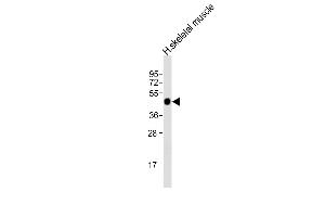 Anti-AGPHD1 Antibody (N-Term)at 1:2000 dilution + human skeletal muscle lysates Lysates/proteins at 20 μg per lane. (AGPHD1 antibody  (AA 65-99))