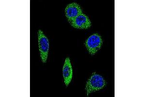 Confocal immunofluorescent analysis of ADRA2B Antibody (Center) (ABIN652506 and ABIN2842340) with MDA-M cell followed by Alexa Fluor® 488-conjugated goat anti-rabbit lgG (green). (ADRA2B antibody  (AA 343-369))