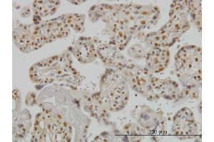 Immunoperoxidase of monoclonal antibody to SMAD3 on formalin-fixed paraffin-embedded human placenta. (SMAD3 antibody  (AA 120-221))