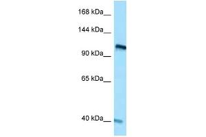 WB Suggested Anti-RET Antibody Titration: 1. (Ret Proto-Oncogene antibody  (C-Term))